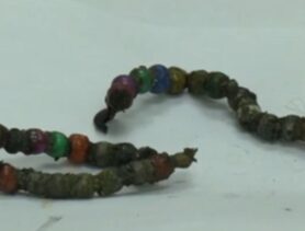 В Гомеле ребёнок наглотался магнитов